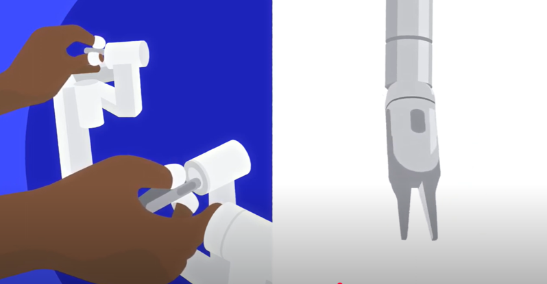 Robotic-Assisted Surgery | What to Expect Thumbnail