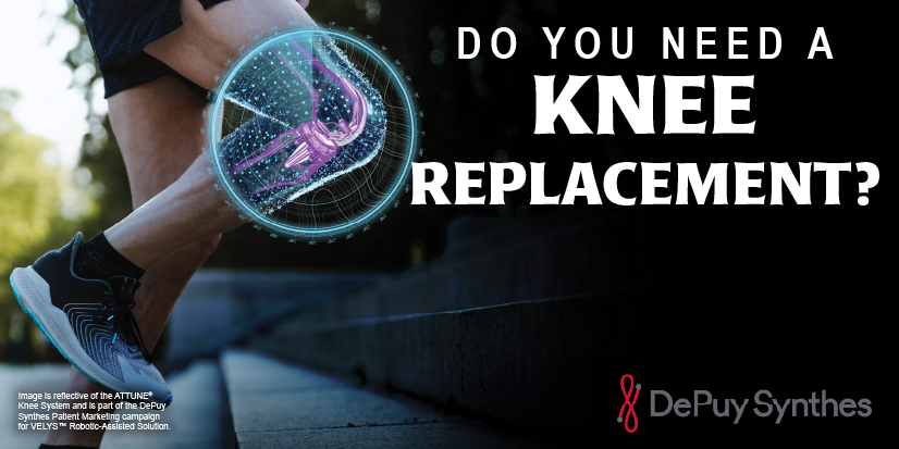 Do I Need a Knee Replacement Surgery?