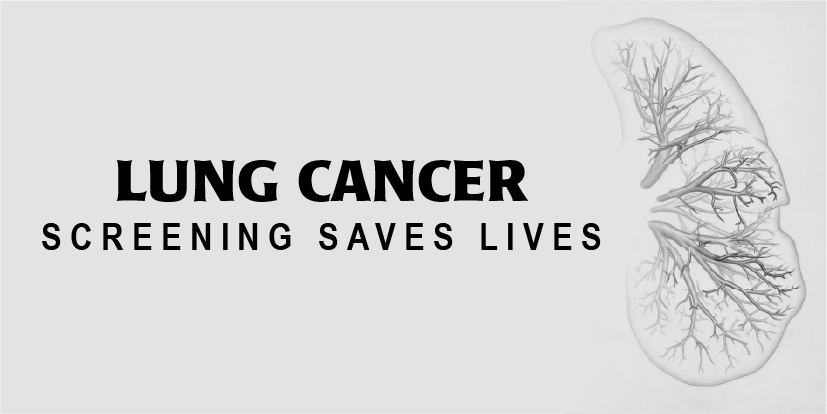 Lung cancer screening saves lives